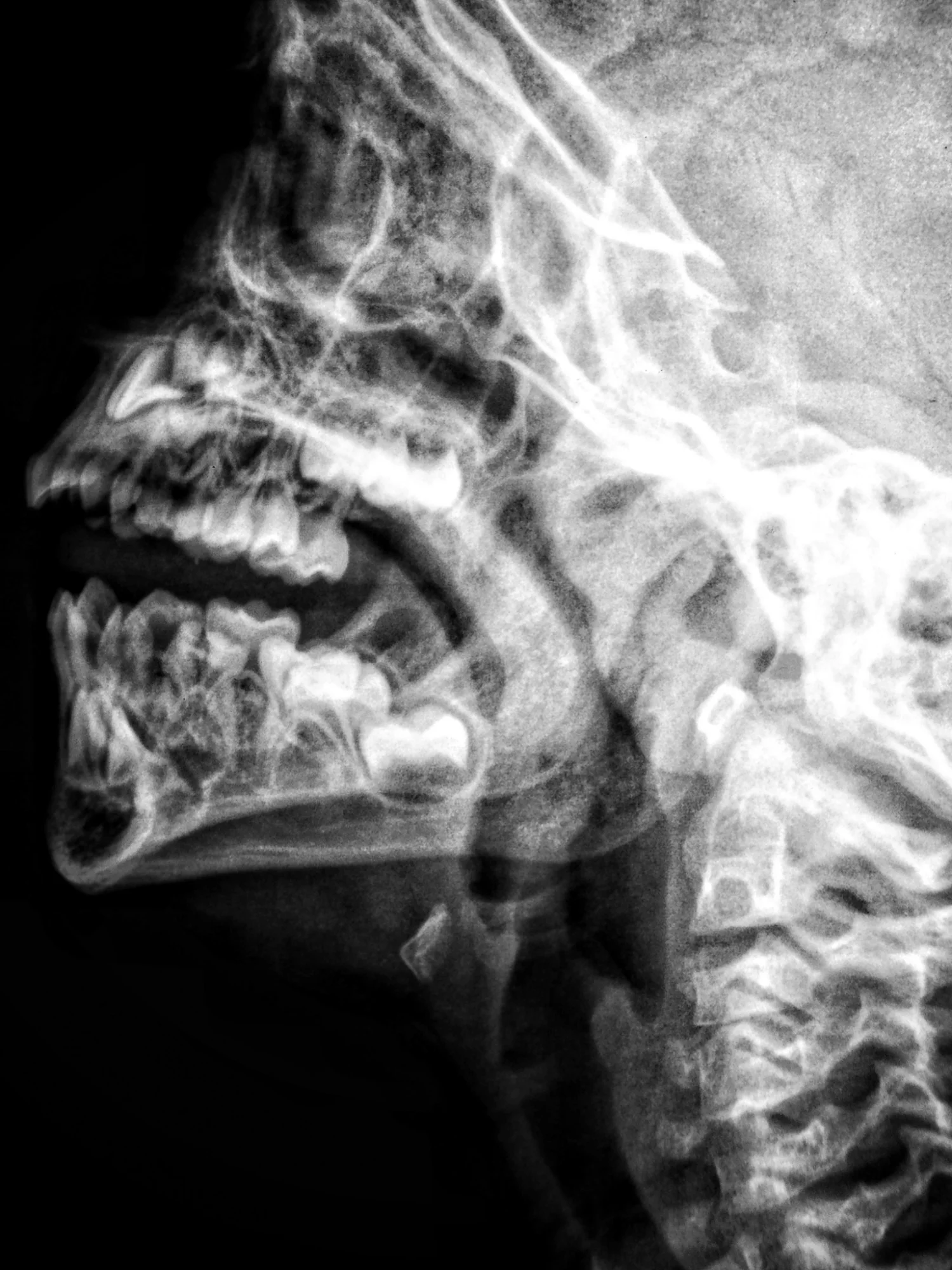 X-ray illustration of head and speech